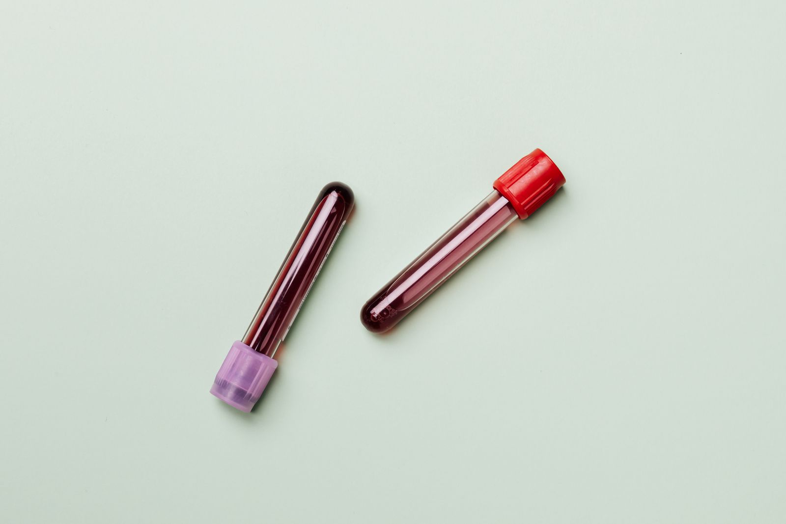 Dos tubos de muestra de sangre con tap&oacute;n morado y rojo sobre un fondo verde claro